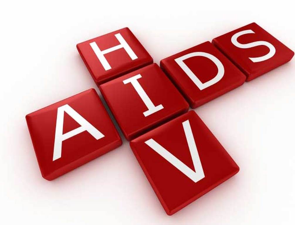 HIV AIDS